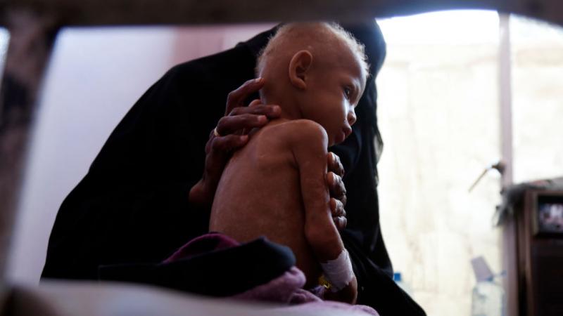 يموت حوالي 50 ألف يمني جوعًا في ظروف تشبه المجاعة.