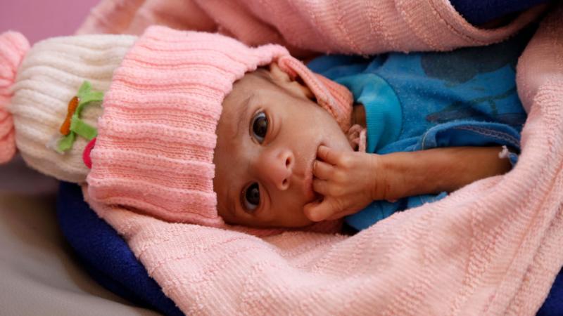 بات 80% من سكان اليمن، البالغ عددهم نحو 30 مليون نسمة، يعتمدون على المساعدات للبقاء أحياء (غيتي)