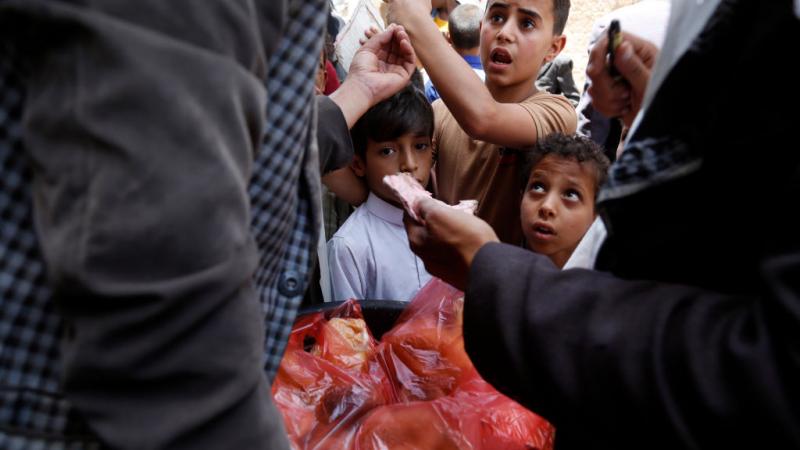 يعاني الأطفال في اليمن من سوء التغذية الحاد بسبب الأوضاع في البلاد