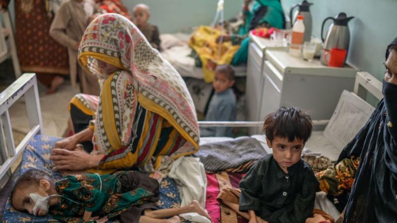 حذرت الأمم المتحدة من أنه بحلول نهاية العام سيحتاج مليون طفل أفغاني دون سن الخامسة للعلاج من سوء التغذية الحاد