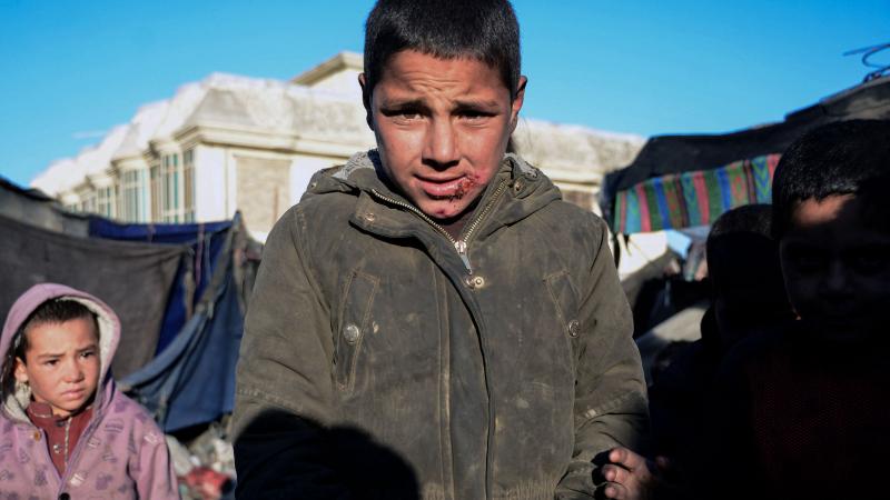 حذّرت وكالات إغاثية دولية من أن أكثر من نصف سكان أفغانستان قد يعانون الجوع (غيتي)