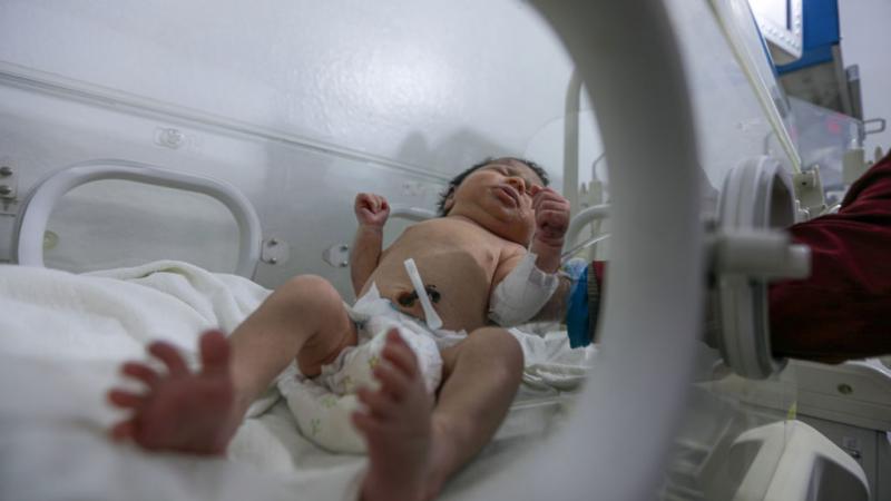 الرضيعة آية أثناء تلقيها العلاج في المستشفى - غيتي