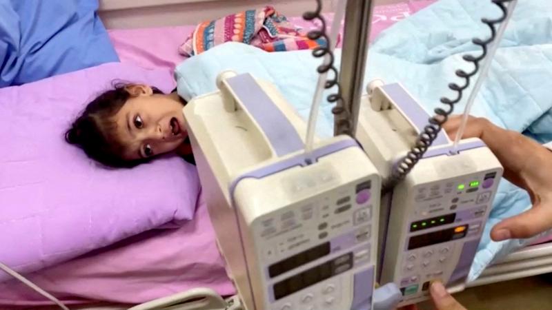 يعاني مرضى السرطان من تبعات العدوان الإسرائيلي بشكل مضاعف حيث أجبرتهم على عدم استكمال علاجهم- رويترز