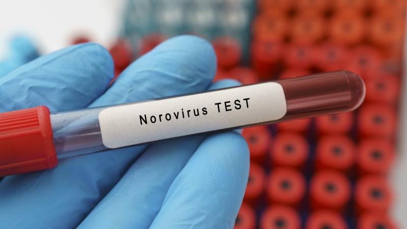 انتشار "نوروفيروس" في الولايات المتحدة - غيتي